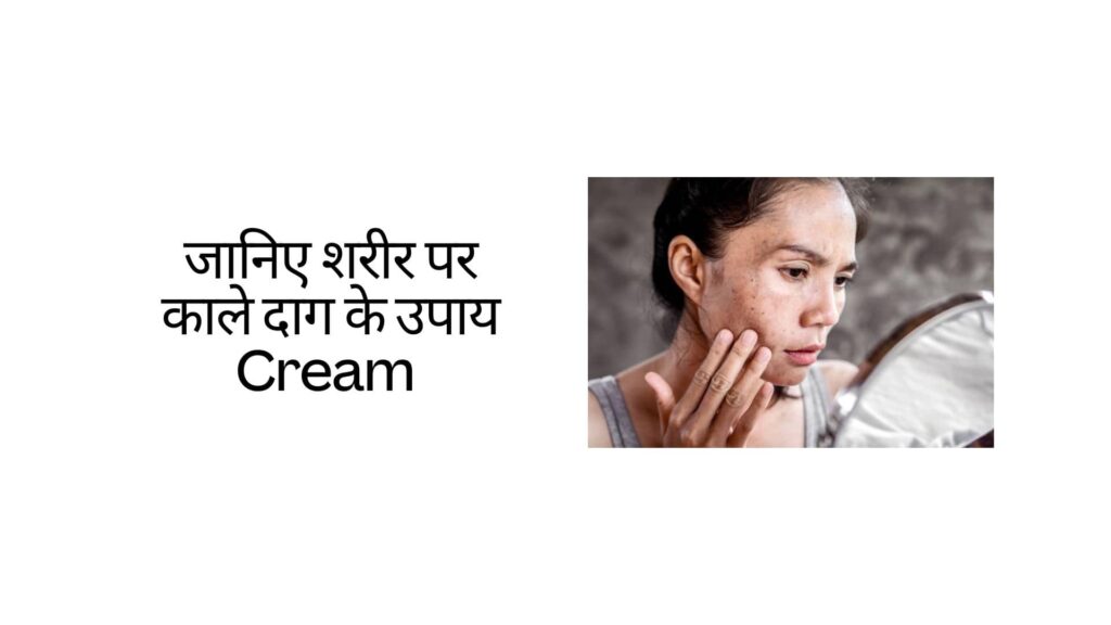 जानिए शरीर पर काले दाग के उपाय Cream | Janiye Sharir Par Kaale Daag Ke Upaay Cream Hindi Mei